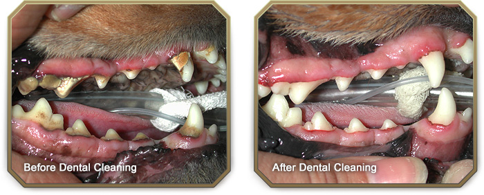 Before and After Dental Cleaning